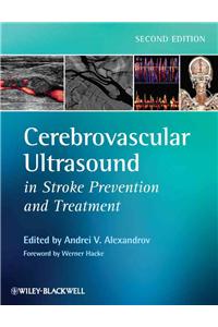Cerebrovascular Ultrasound in Stroke Prevention and Treatment
