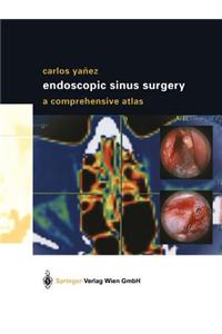 Endoscopic Sinus Surgery