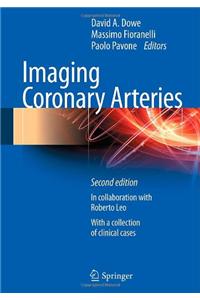 Imaging Coronary Arteries