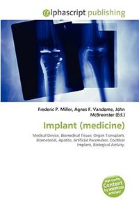 Implant (Medicine)