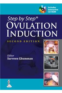 Step by Step Ovulation Induction