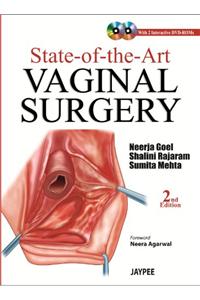 State-of-the-Art Vaginal Surgery