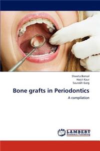 Bone Grafts in Periodontics