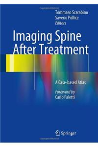 Imaging Spine After Treatment: A Case-Based Atlas