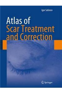 Atlas of Scar Treatment and Correction