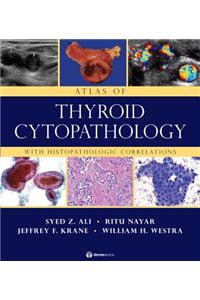 Atlas of Thyroid Cytopathology: With Histopathologic Correlations