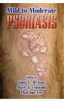 Mild to Moderate Psoriasis