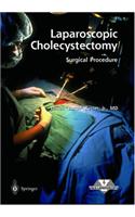 Laparoscopic Cholecystectomy