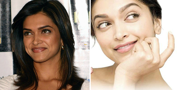 8 Bollywood Divas Who Went For Skin Whitening Treatment ...