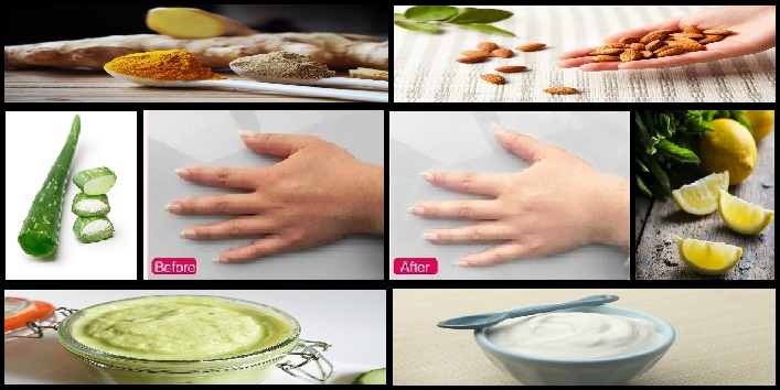 Anti-Tan Home Remedies To Get Tan-Free Beautiful Hands At ...