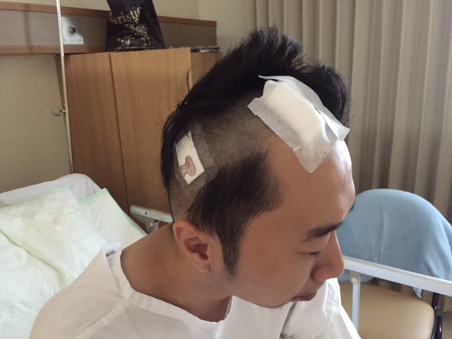 bpjs operasi otak tumor Bantu Frederik Otak  Tumor Melawan Kitabisa!
