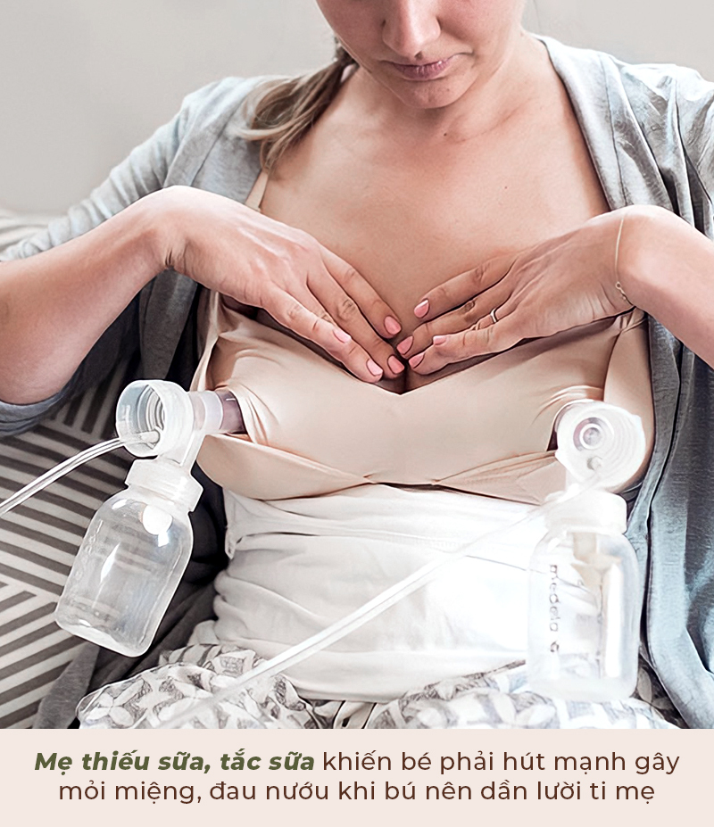 Giải mã nỗi lo của 90% mẹ bỉm: Vì sao bé đột nhiên ngừng bú, quấy khóc? Mẹ thiếu sữa, tắc sữa khiến bé phải hút mạnh gây mỏi miệng, đau núm khi bú nên dẫn lùi ti mẹ. Khám phá nguyên nhân bé bỏ bú và tìm mẹo cho bé bú khỏe.