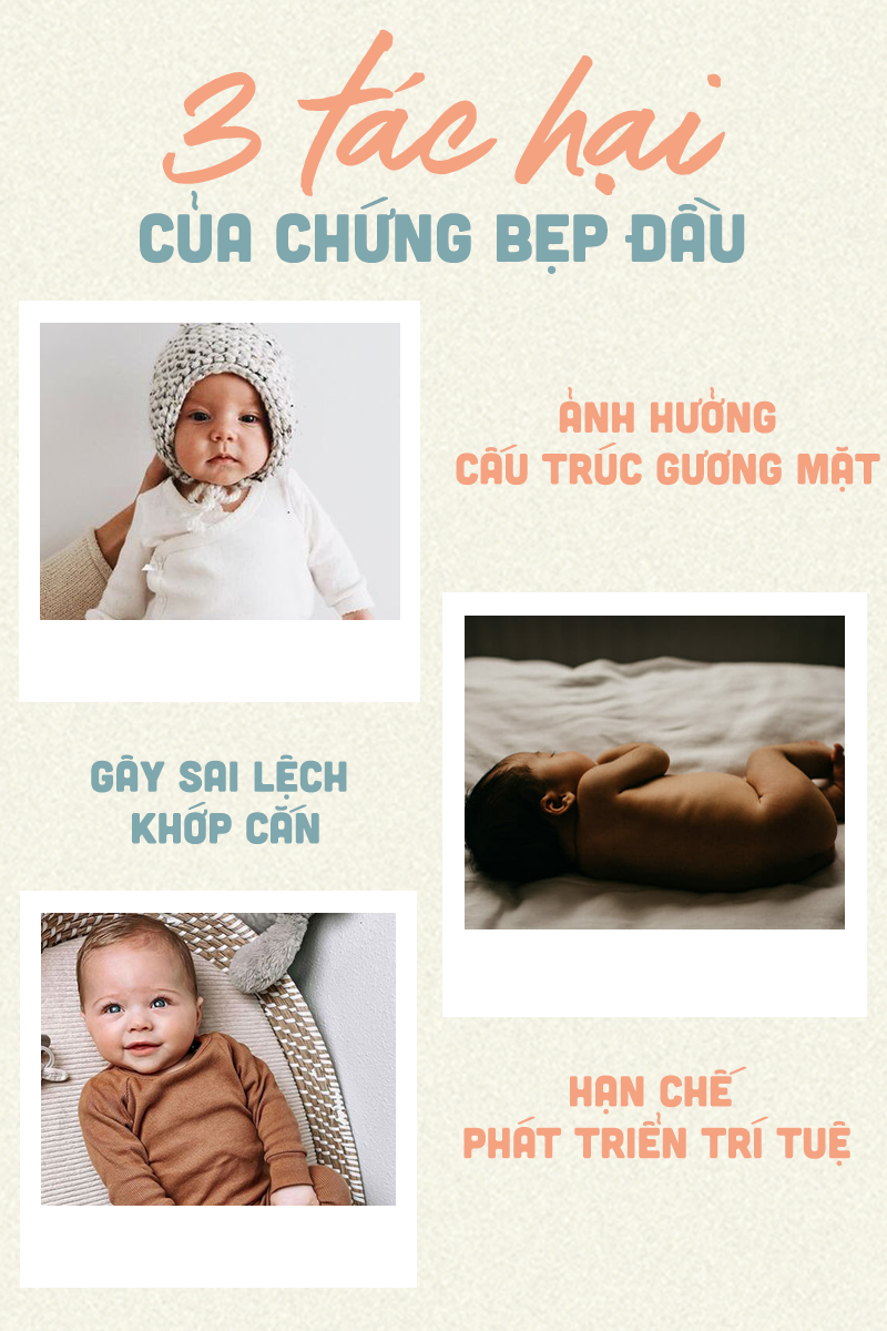 Bài viết đề cập tới 3 tác hại của chứng bẹp đầu ở trẻ sơ sinh, bao gồm ảnh hưởng đến cấu trúc gương mặt, gây sai lệch khớp cằm và hạn chế phát triển trí tuệ. Tham khảo để mẹ và bé cùng an tâm xua tan nỗi lo bẹp đầu.