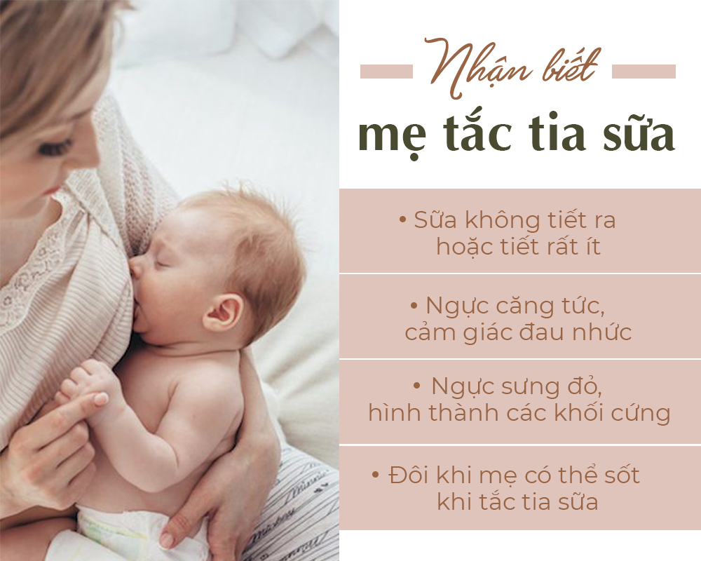 Nhận biết tình trạng tắc tia sữa ở mẹ bỉm sau sinh với các dấu hiệu như sữa không tiết ra hoặc tiết rất ít, ngực căng tức, cảm giác đau nhức và nguy cơ bị sốt.