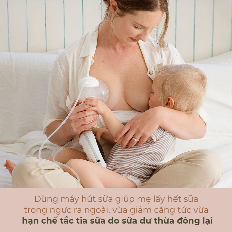 Dùng máy hút sữa giúp mẹ lấy hết sữa trong ngực ra ngoài, vừa giảm căng tức và hạn chế tắc tia sữa do sữa dư thừa đông lại. Bài viết cung cấp mẹo ngừa tắc tia sữa hiệu quả cho mẹ và bé.
