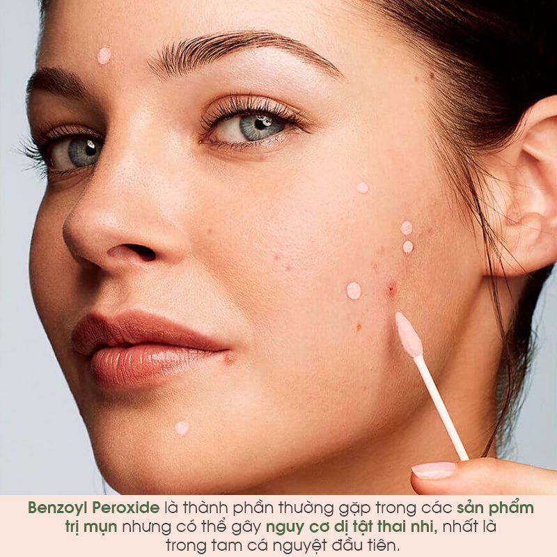 Bài viết giới thiệu 5 thành phần mỹ phẩm không an toàn cho mẹ bầu như Benzoyl Peroxide, giúp mẹ và bé tránh tác dụng phụ không mong muốn, mang lại tự tin trong quá trình chăm sóc bản thân trong thai kỳ.