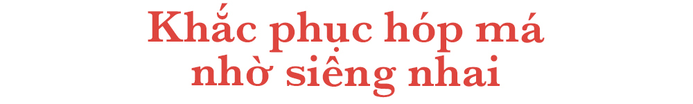 Khắc phục hóp má nhờ siêng nhai, là một trong những lưu ý quan trọng khi niềng răng. Bài viết cung cấp mẹo giữ vệ sinh răng miệng, ngừa hôi miệng và giảm hóp má để duy trì vẻ đẹp và hơi thở thơm mát trong suốt quá trình niềng răng.