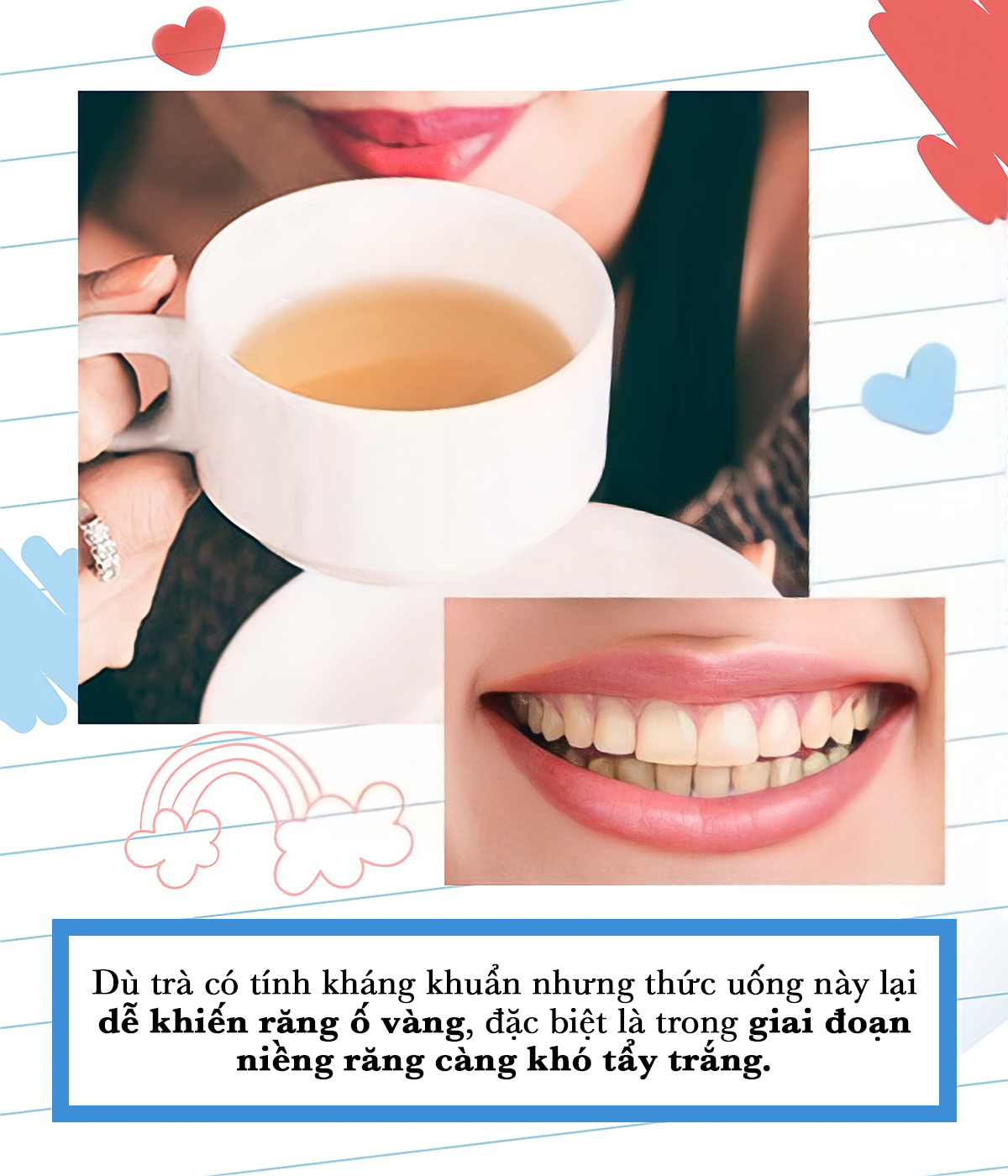 Dù trà có tính kháng khuẩn nhưng thức uống này lại dễ khiến răng ố vàng, đặc biệt là trong giai đoạn niềng răng càng khó tẩy trắng. Lưu ý về vệ sinh răng miệng khi niềng răng cùng sản phẩm tăm nước Halio để ngừa hôi miệng và giảm hóp má.