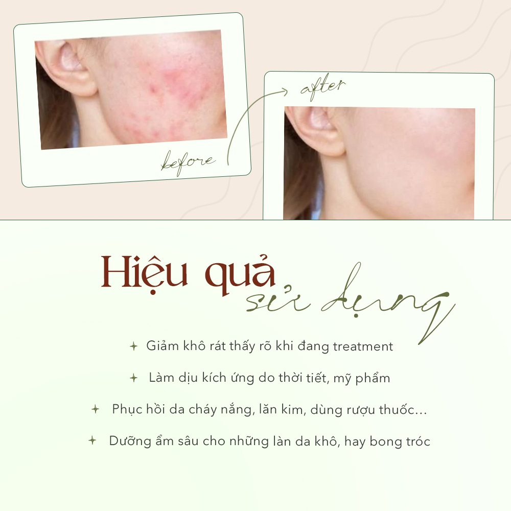 Bài viết giới thiệu 3 serum mới của thương hiệu The Auragins dành cho da xỉn màu, tiết dầu và lỗ chân lông lớn. Hiệu quả như giảm kích ứng, phục hồi da và dưỡng ẩm sâu cho làn da mùa hè.