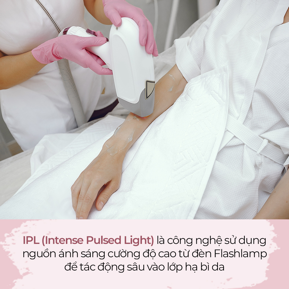 Công nghệ IPL (Intense Pulsed Light) được áp dụng trong chăm sóc da, mang lại nhiều lợi ích. Hình ảnh mô tả quy trình triệt lông hiệu quả với thiết bị Halio IPL, giúp cải thiện làn da và nhanh chóng thấy kết quả. Khám phá ngay những ưu nhược điểm của công nghệ IPL!