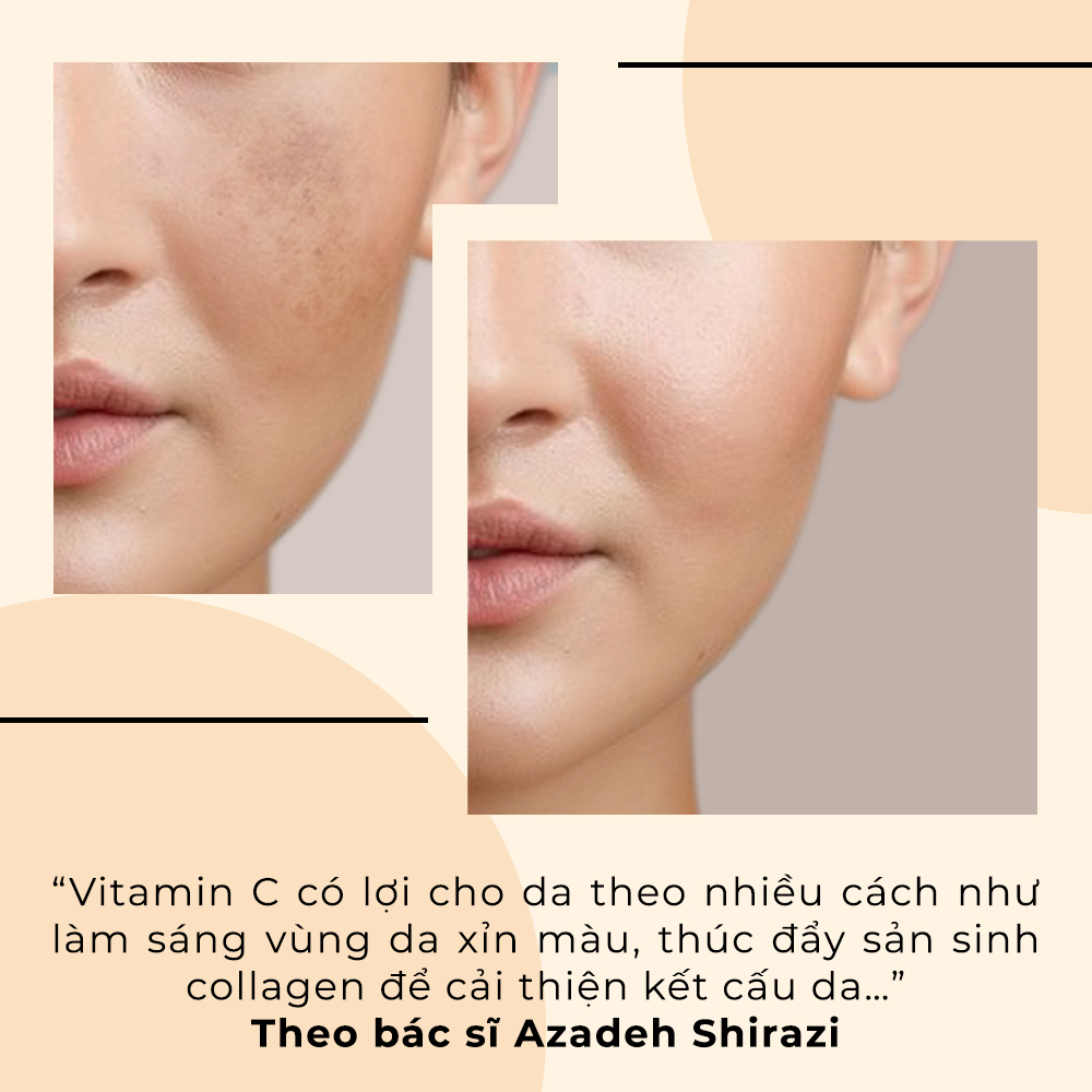 "Vitamin C có lợi cho da theo nhiều cách như làm sáng vùng da xỉn màu, thúc đẩy sản sinh collagen để cải thiện kết cấu da..." Theo bác sĩ Azadeh Shirazi. Bài viết về tác dụng của vitamin C và retinol trong quy trình skincare, khám phá có thể kết hợp retinol cùng vitamin C.