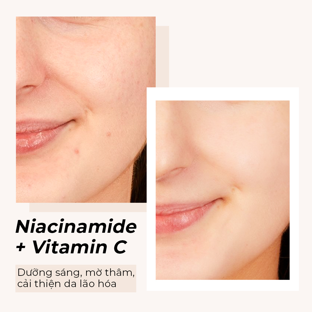 Niacinamide kết hợp Vitamin C có thể gây kích ứng da. Khám phá lợi ích của Niacinamide và Vitamin C giúp dưỡng sáng, cải thiện da lão hóa. Tìm hiểu thêm về niacinamide và vitamin C trong skincare.
