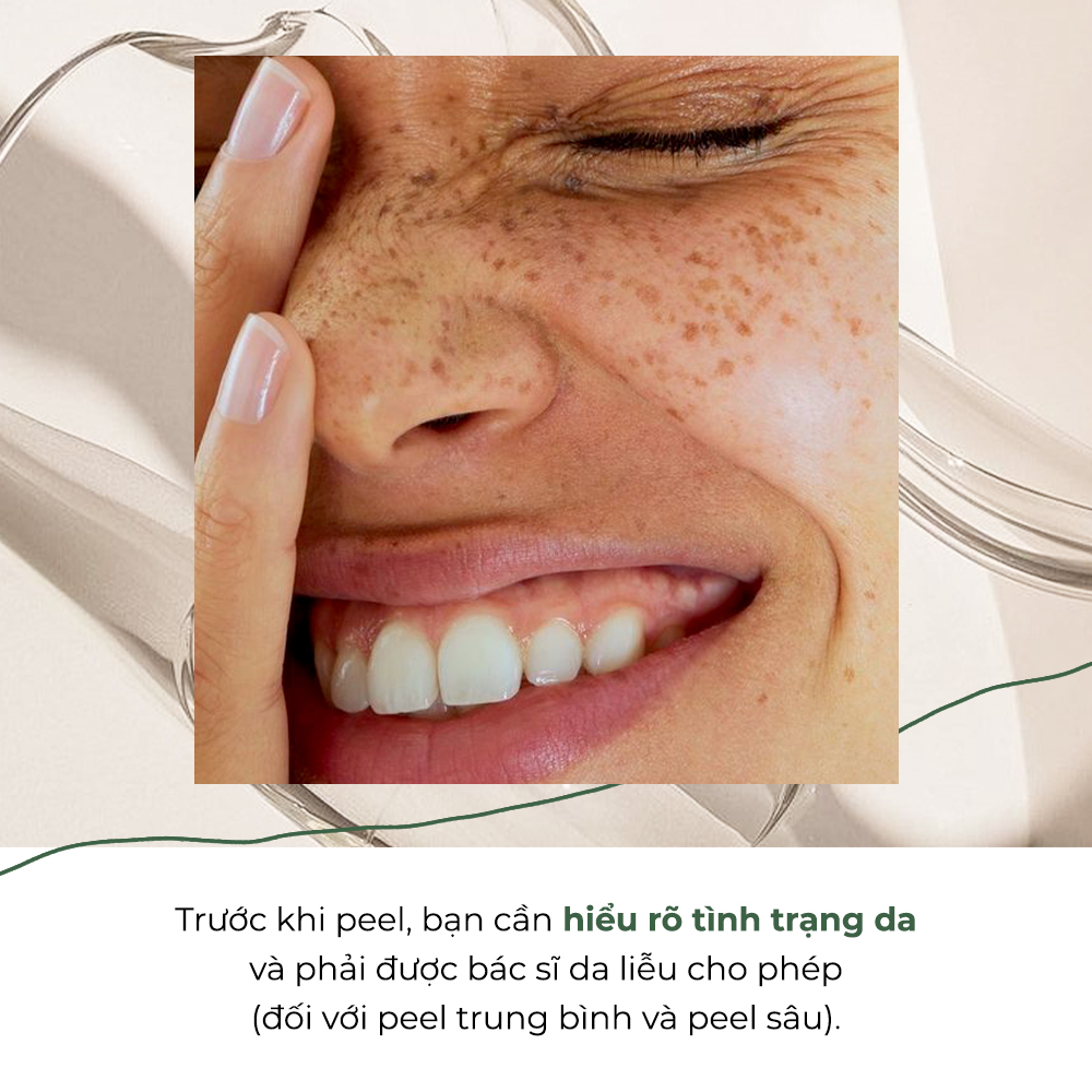 Tổng quan kiến thức peel da cho người mới bắt đầu: Peel là gì? Công dụng và lưu ý; biết rõ tình trạng da trước khi peel để chọn sản phẩm peel da an toàn và phù hợp như peeling serum hay sản phẩm peel da The Auragins.