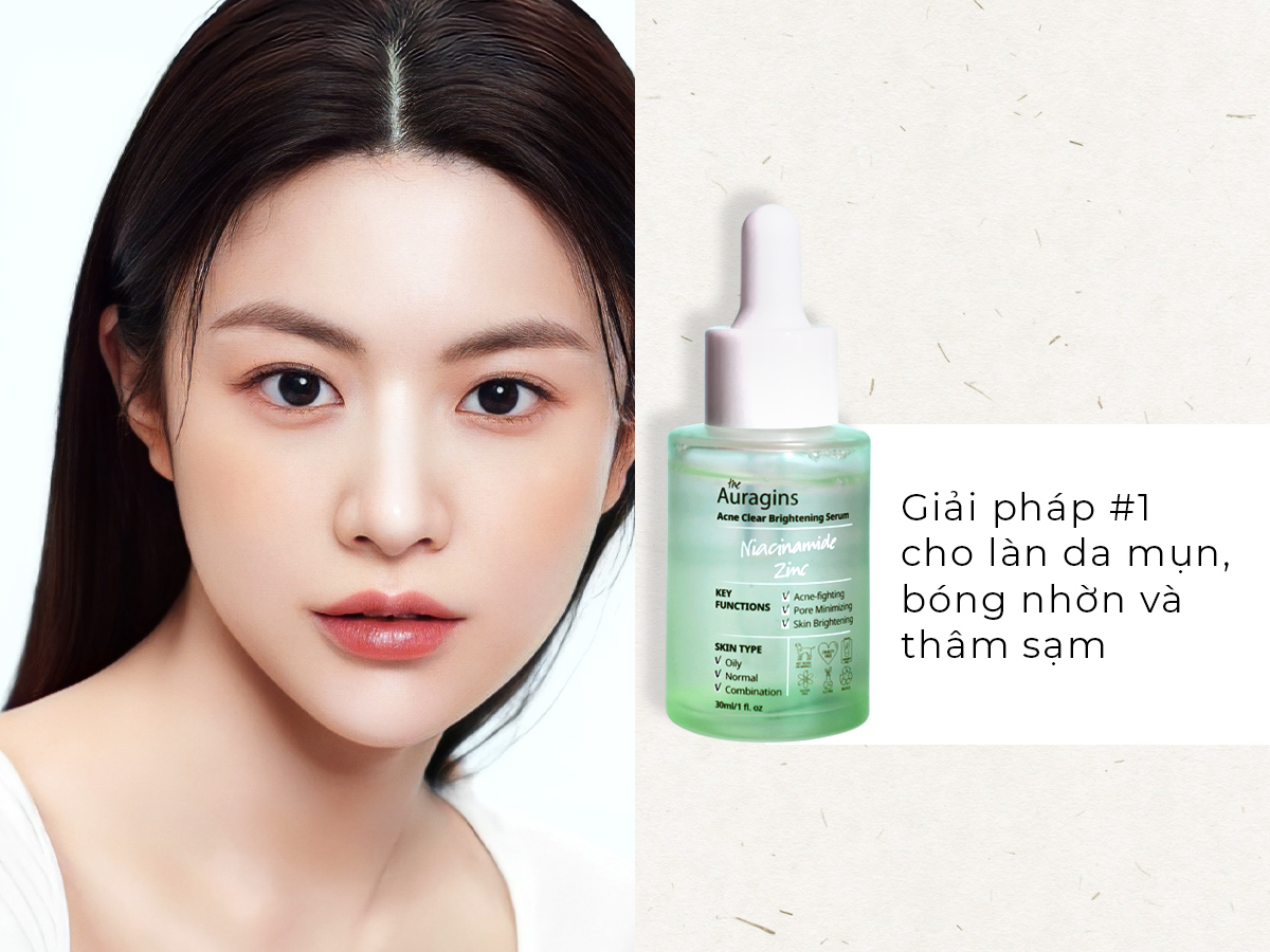 Skincare da dầu mụn với serum Niacinamide và Zinc từ thương hiệu The Auragins, giải pháp lý tưởng cho làn da dầu, lỗ chân lông to, giúp kiềm dầu, ngừa mụn, nuôi dưỡng làn da khỏe mạnh.