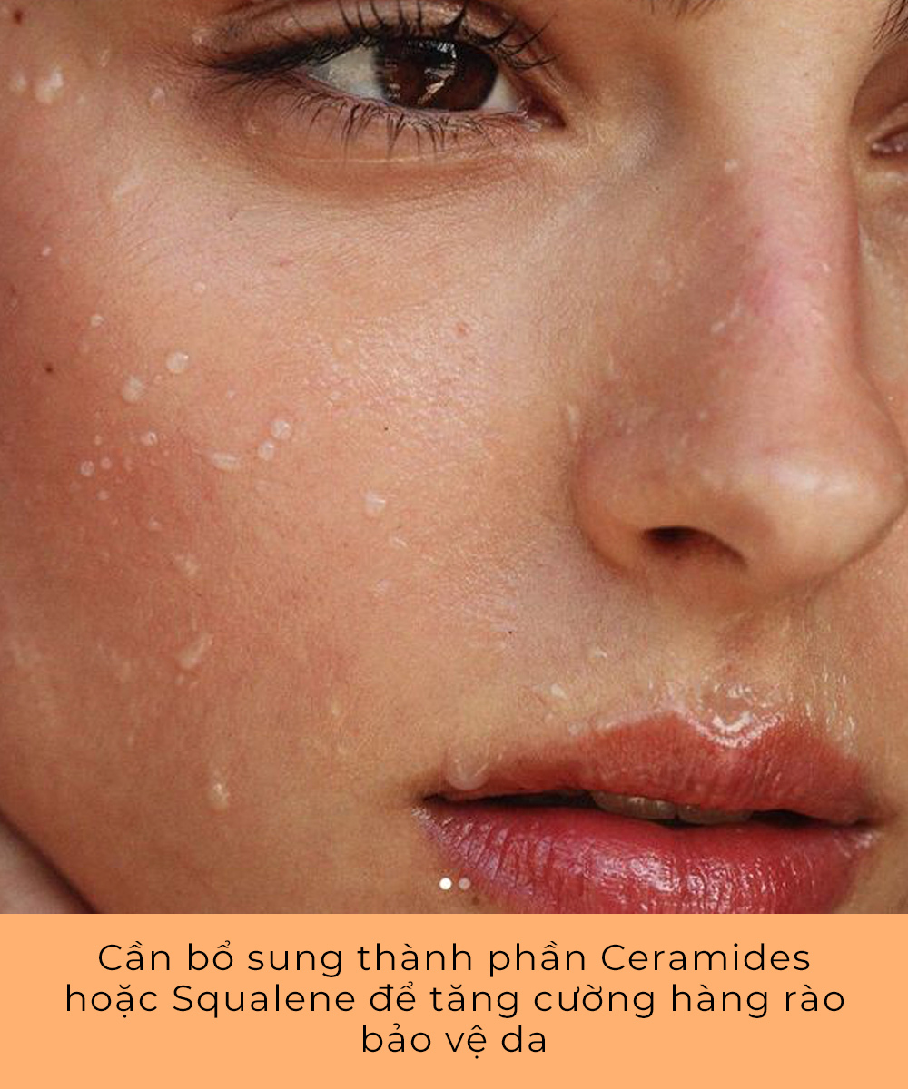 Cần bổ sung thành phần Ceramides hoặc Squalene để tăng cường hàng rào bảo vệ da, giúp cải thiện hiệu quả trong việc chống nắng và ngăn ngừa lão hóa sớm, chia sẻ từ chuyên gia trong Lixibox Magazine.