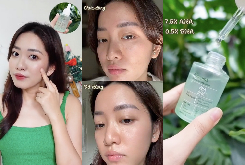 Bộ đôi serum The Auragins với 7,5% AHA và 0,5% BHA được các beauty bloggers nổi tiếng như Ling Sim, Trang Ash khuyến nghị sử dụng cho làn da dầu mụn, giúp da căng mịn, cải thiện lỗ chân lông, hoàn hảo cho dịp Tết. Khám phá Lixibox Review để tìm hiểu thêm!