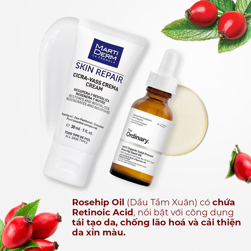 Bài viết của Lixibox Magazine giới thiệu 8 thành phần mỹ phẩm thay thế Retinol hiệu quả cho da nhạy cảm và bà bầu, bao gồm các sản phẩm như Rosehip Oil và Cica-Vass Cream giúp trị mụn, dưỡng trắng, và cải thiện sắc tố da.