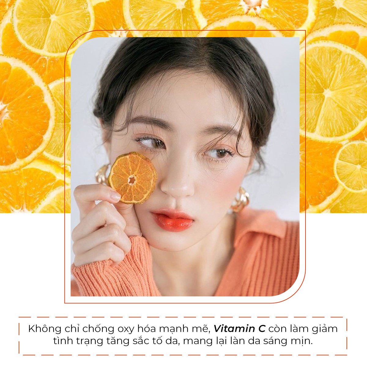 Bài viết nói về 7 thành phần mỹ phẩm dưỡng trắng da hiệu quả. Vitamin C không chỉ chống oxy hóa, còn giúp làm giảm tình trạng tăng sắc tố, mang lại làn da sáng mịn, cùng các thành phần như Niacinamide, Kojic Acid, Retinol, Arbutin giúp cải thiện sắc độ cho làn da.