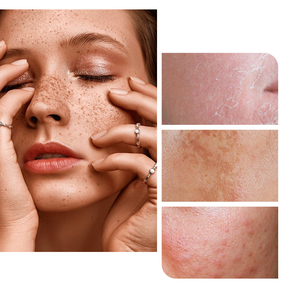 Bài viết thảo luận về việc có nên dùng Retinol vào mùa hè hay không, cùng các cách dùng Retinol giúp da không bị tối màu hay kích ứng, với sự tư vấn từ các chuyên gia da liễu của Lixibox Skincare.