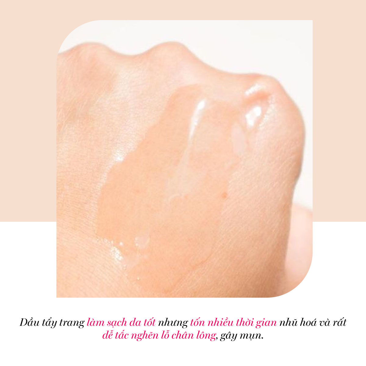 Dầu tẩy trang làm sạch da tốt nhưng tốn nhiều thời gian nhũ hóa và rất dễ tắc nghẽn lỗ chân lông, gây mụn. Tìm hiểu ưu và nhược điểm các loại tẩy trang từ Lixibox để chọn sản phẩm phù hợp cho da.