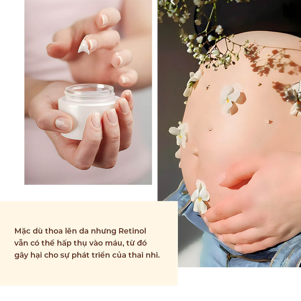 Bài viết về Retinol trong quy trình chăm sóc da cho mẹ bầu, làm rõ thắc mắc liệu mẹ bầu có được dùng retinol không và gợi ý thành phần thay thế Retinol an toàn, hữu ích cho sức khỏe thai nhi.