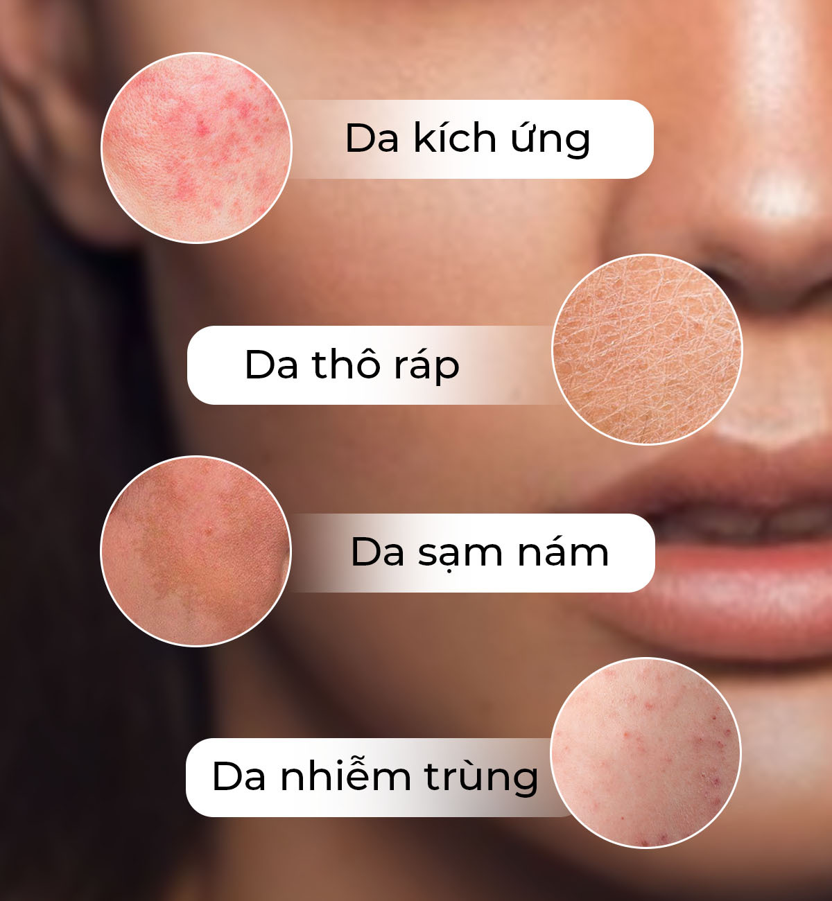Các loại da gặp vấn đề như da kích ứng, da thô ráp, da sạm nám và da nhiễm trùng. Bài viết trên Lixibox khám phá xu hướng làm đẹp 2023, nhấn mạnh tầm quan trọng của củng cố và phục hồi hàng rào bảo vệ da.
