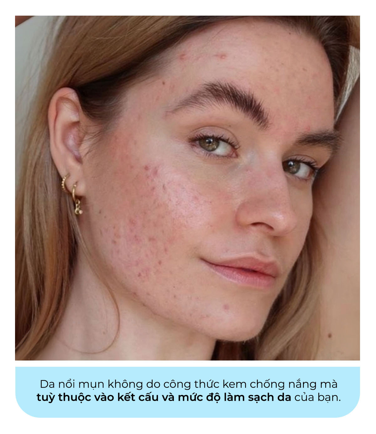 Giải đáp các thắc mắc về kem chống nắng, Lixibox Skincare giúp bạn hiểu rõ hơn về việc sử dụng kem chống nắng đúng cách, những câu hỏi thường gặp và tác động của sản phẩm đến làn da.