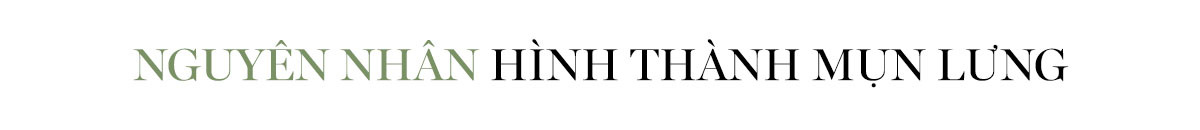 Nguyên nhân hình thành mụn lưng được giới thiệu trong bài viết của Lixibox. Chị em sẽ tìm được giải pháp trị mụn lưng dứt điểm và tự tin diện bikini, khám phá những mẹo chăm sóc da hiệu quả.