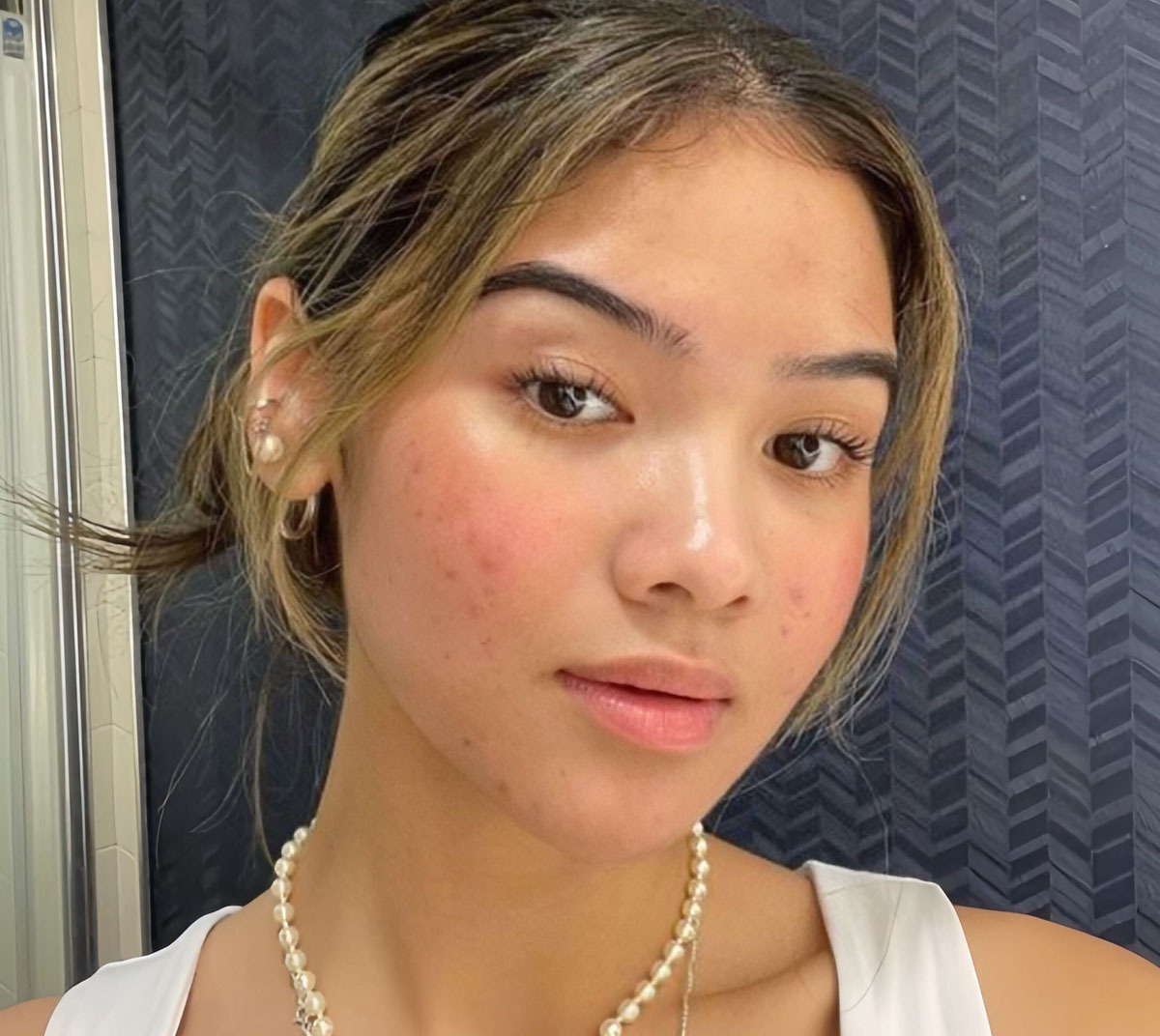 Khám phá bài viết từ Lixibox Skincare về miếng dán mụn, công dụng, và lời khuyên từ chuyên gia Reid Maclellan và Jeannette Graf. Hãy tìm hiểu xem có nên dùng miếng dán mụn không và tác dụng của chúng đối với làn da dầu dễ nổi mụn!