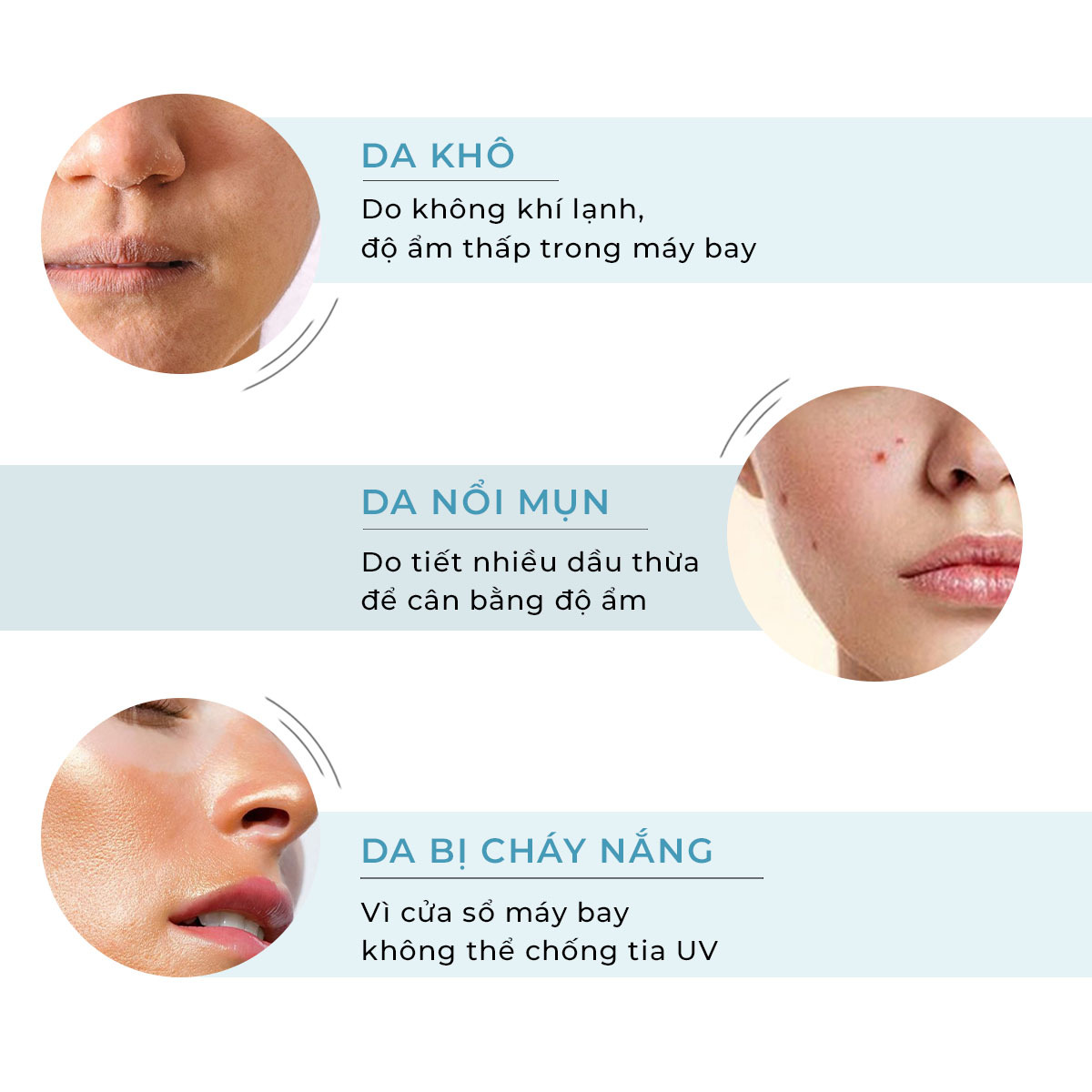 Bài viết về cách chăm sóc da trên máy bay, chỉ ra những vấn đề như da khô do không khí lạnh, da nổi mụn vì tiết nhiều dầu thừa, và da bị cháy nắng do cửa sổ không chống tia UV. Tìm hiểu về chăm da trên máy bay cùng Lixibox Skincare.