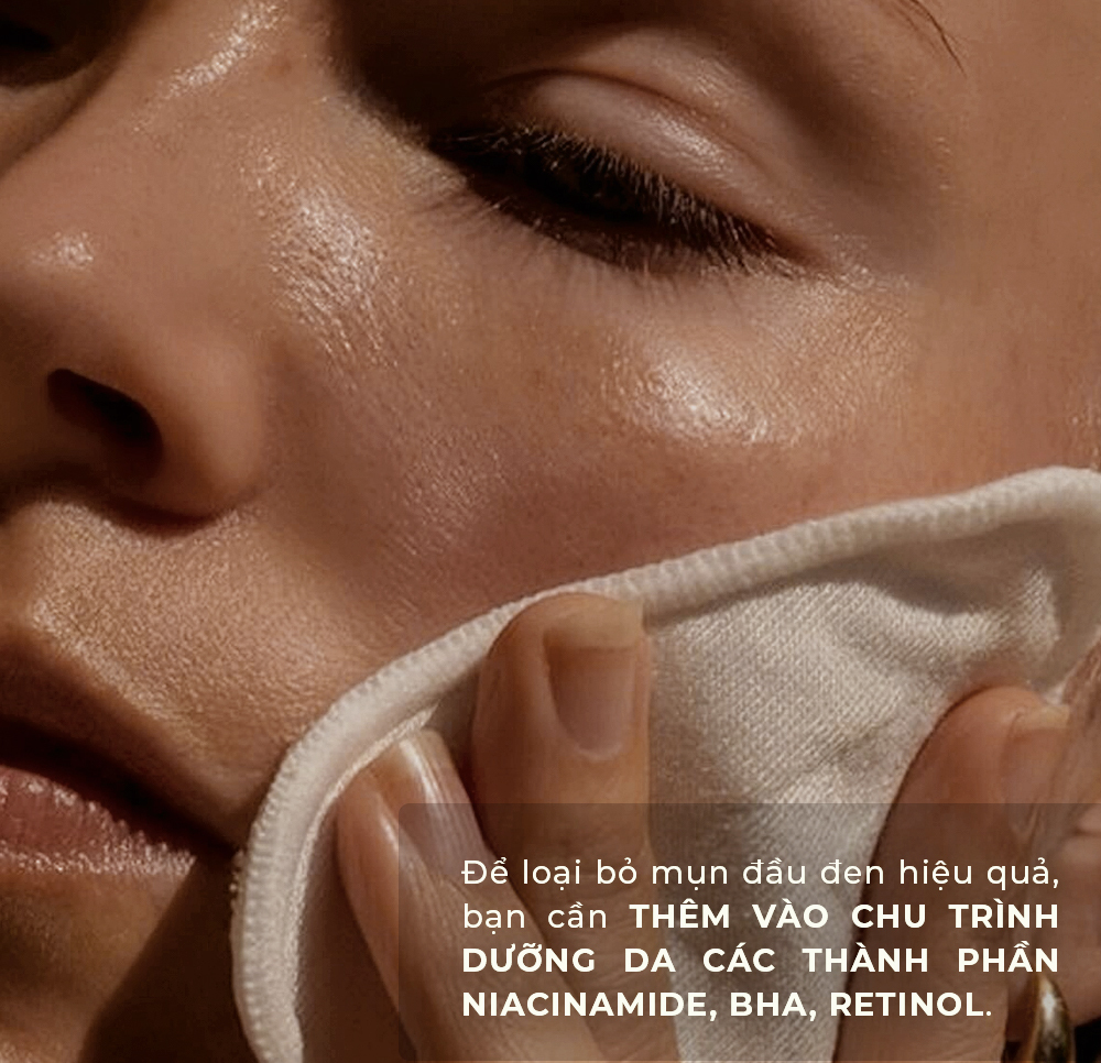 Bài viết trên Lixibox giải đáp câu hỏi có nên nặn mụn đầu đen không và những cách trị mụn đầu đen hiệu quả. Tìm hiểu các thành phần như Niacinamide, BHA, và Retinol để chăm sóc da tốt hơn.