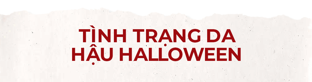 Tình trạng da hậu Halloween - tìm hiểu cách chăm sóc da hiệu quả để tránh nổi mụn sau khi trang điểm đậm mùa Halloween với các sản phẩm phù hợp từ Lixibox Skincare. Khám phá skincare routine giúp bạn tự tin hơn trong mùa lễ hội.