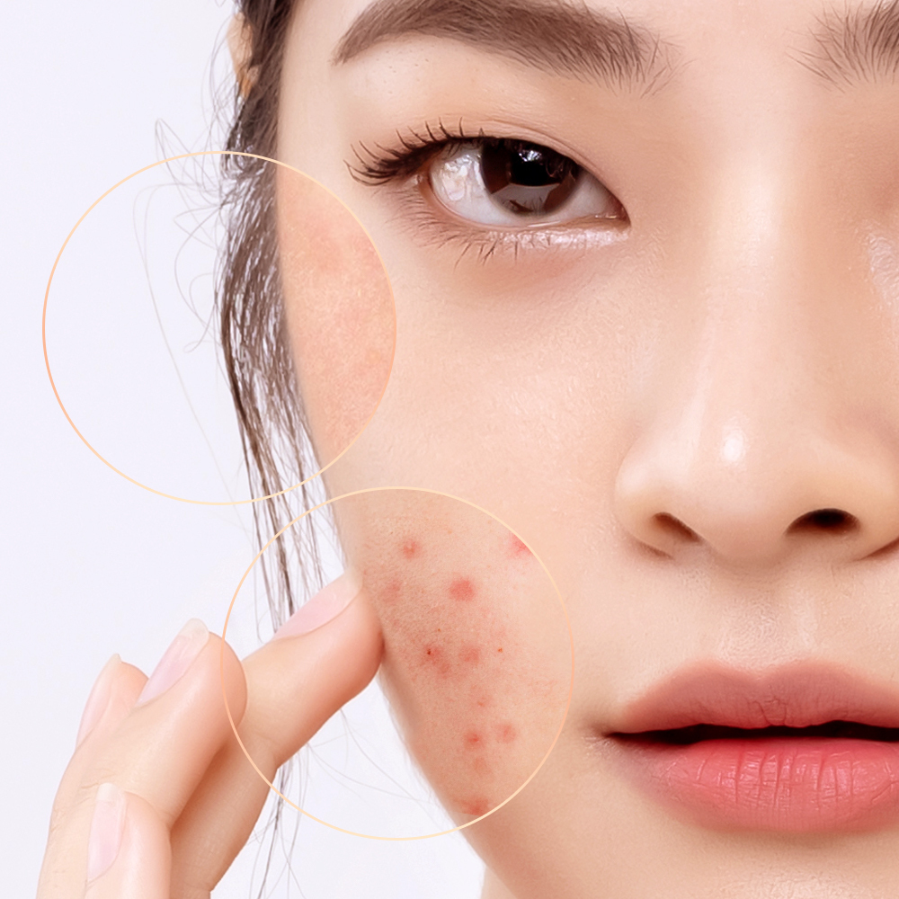Bài viết khám phá tác hại của các thành phần mỹ phẩm không tốt cho da, giúp tín đồ làm đẹp nhận biết và tránh xa các thành phần độc hại đang tràn lan trên thị trường. Tham khảo danh sách các thành phần nên tránh trong mỹ phẩm từ Lixibox.