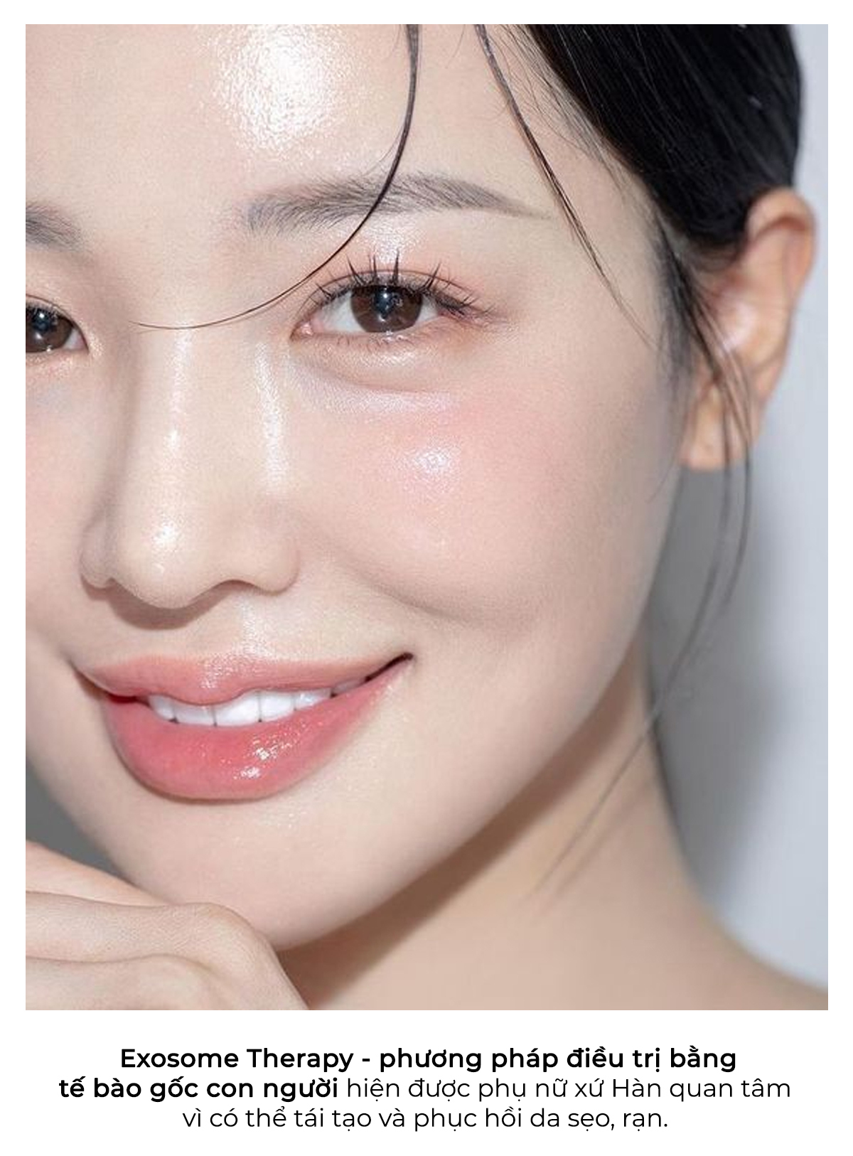 Khám phá xu hướng Exosome Therapy trong K-Beauty giúp phục hồi da hiệu quả. Bài viết giới thiệu 7 trend làm đẹp hot ở Hàn Quốc 2023 mà tín đồ Lixibox Skincare không thể bỏ qua!