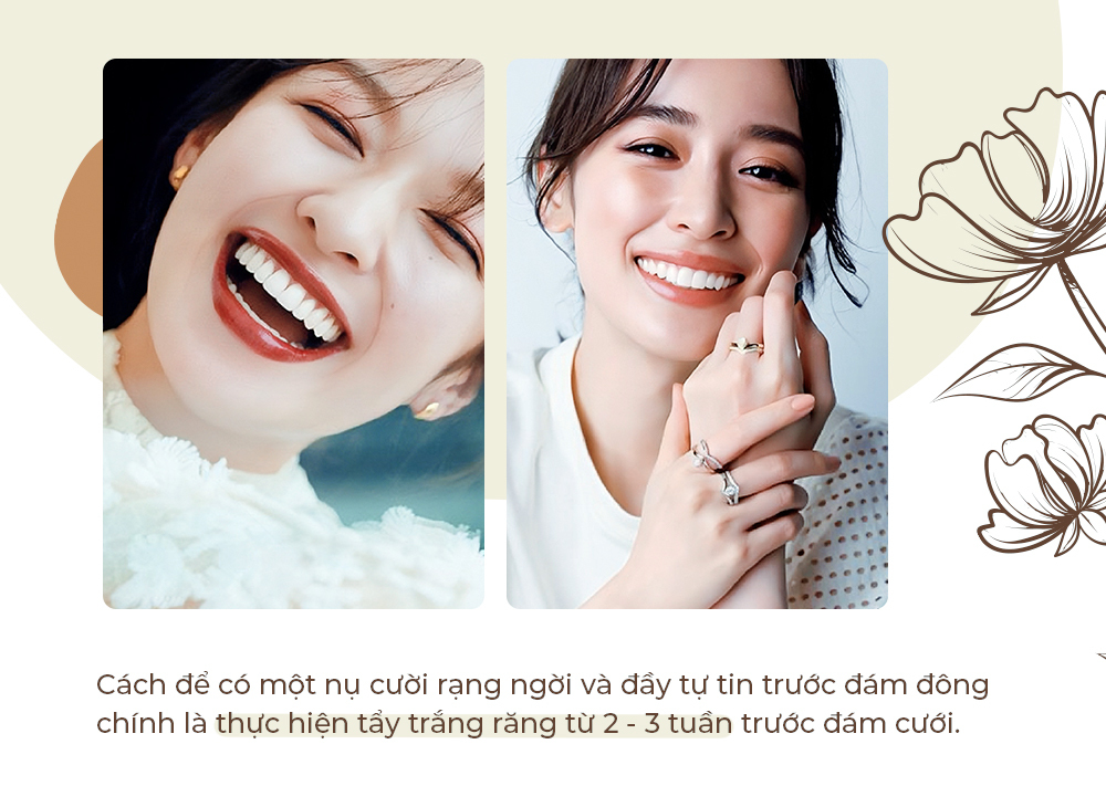 Cách để có một nụ cười rạng ngời và đầy tự tin trước đám cưới chính là thực hiện tẩy trắng răng từ 2 - 3 tuần trước đám cưới. Bài viết trên Lixibox sẽ hướng dẫn cô dâu cần chuẩn bị gì cho ngày cưới thật hoàn hảo, đặc biệt cho mùa cưới 2023.