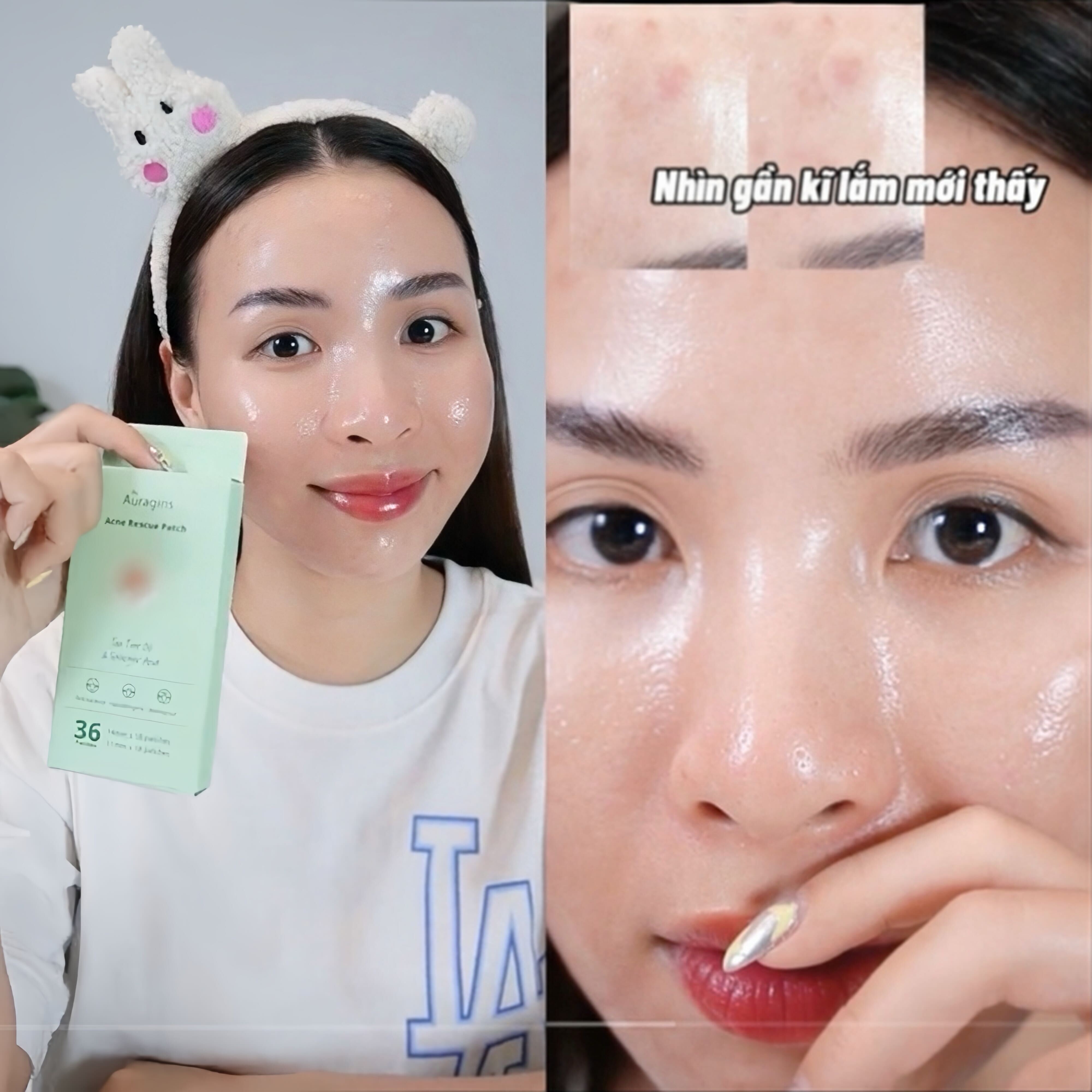 Miếng dán mụn The Auragins Acne Rescue Patch đang được review bởi một TikToker, cho thấy sản phẩm trên mặt và da gần gũi. Bài viết bàn về chất lượng và trải nghiệm sử dụng miếng dán mụn, có sự hoài nghi ban đầu nhưng nhiều TikToker đã thay đổi tư duy sau khi dùng thử. Đây là một phần trong bài viết Lixibox review, thuộc GWP Vietnam, nhấn mạnh vào lợi ích và hiệu quả cho da dầu mụn.