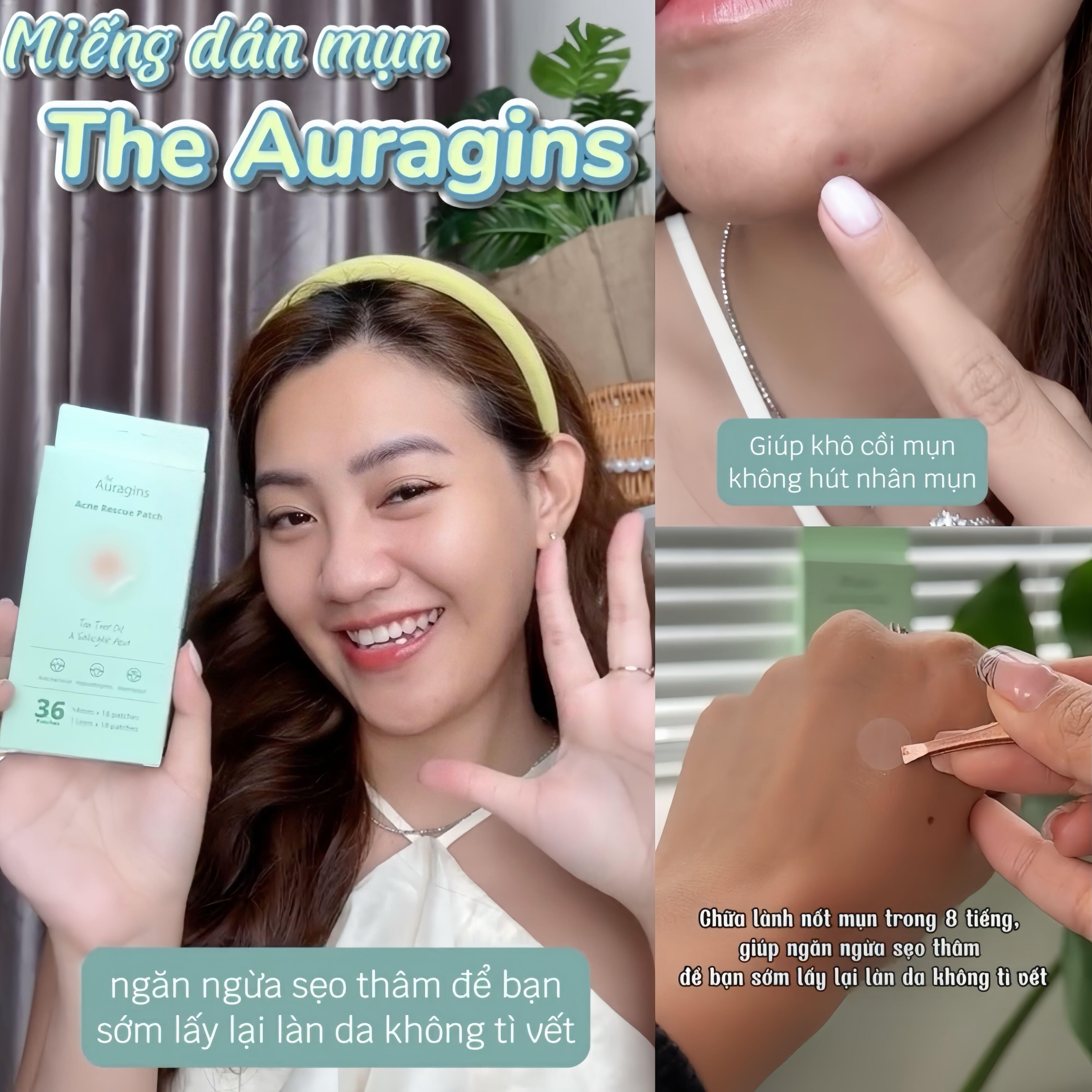 Hoài nghi chất lượng miếng dán mụn The Auragins, TikToker phản hồi tích cực sau khi dùng thử. Bài viết khám phá trải nghiệm và công dụng của miếng dán mụn này, nhấn mạnh công dụng ngăn ngừa sẹo để phục hồi làn da mà không để lại vết thương.