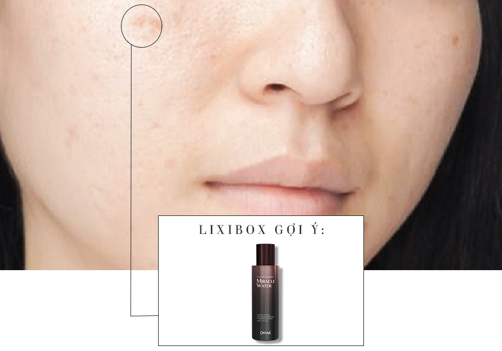 Bài viết về skincare với tiêu đề "Tái tạo làn da toàn diện cùng rau má - bạn đã biết chưa?". Nội dung khám phá tác dụng làm đẹp của rau má trong việc cải thiện làn da, thu hút sự quan tâm của các tín đồ skincare.