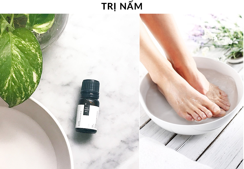 Sản phẩm Kiara Tea Tree Oil đang được giới thiệu trong bài viết về trị mụn, cùng với việc ngâm chân thư giãn. Làn da mụn nhạy cảm được chăm sóc với sản phẩm tự nhiên nhẹ nhàng.