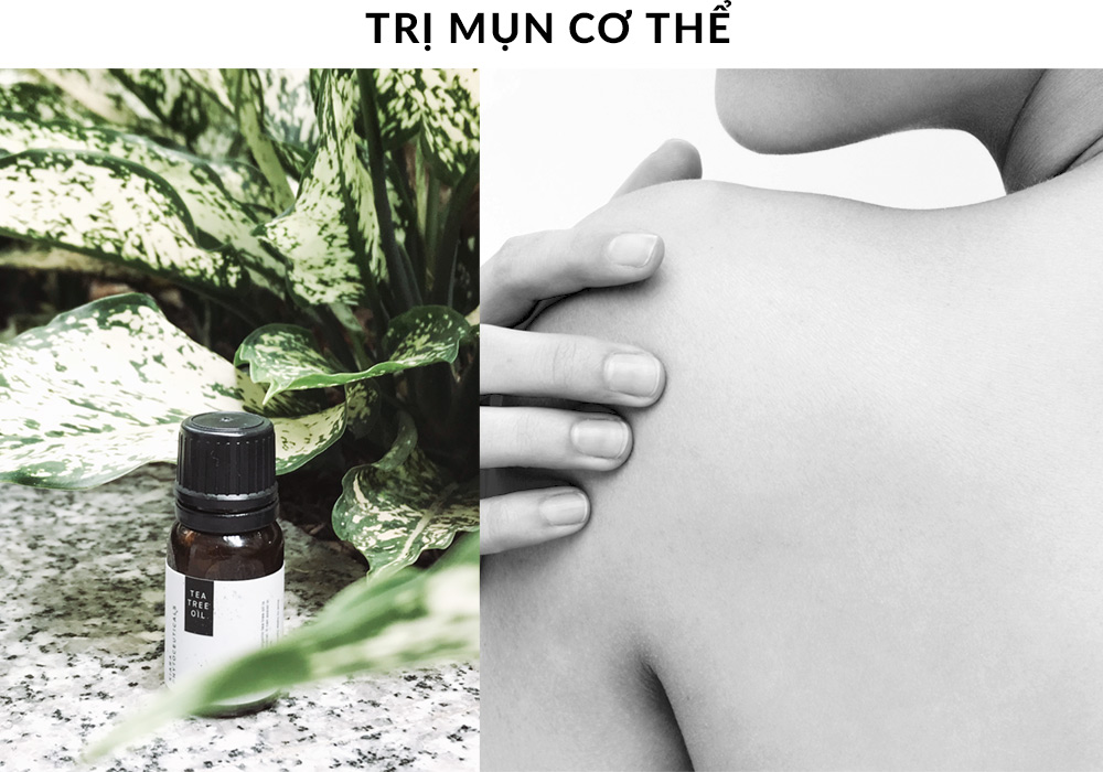 Chai dầu tràm Kiara bên cạnh một làn da mụn nhạy cảm, thể hiện sự kết hợp hoàn hảo giữa hiệu quả trị mụn và sự nhẹ nhàng, phù hợp cho mọi loại da.